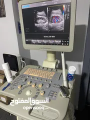  1 شايسون التراساوند Ultrasound نسائية