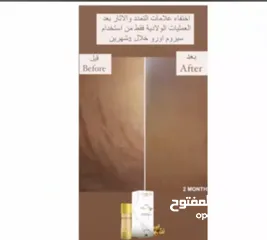  10 غسول منتج اورو الطبيعي للعناية بالبشرة والترطيب اليومي خالي من المواد الكيماوية