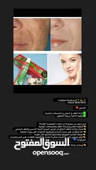  1 كريم فيسكا نيوفورت