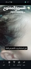  12 كريم ازالة التصبغات والكلف نتائج مضمونه 100%