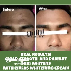  4 كريم تبييض الوجه في غضون 8 أيام. Face whitening cream