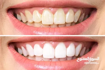  2 تعديل صور احترافي  تحسين جودة وألوان وتعديلات حسب الطلب