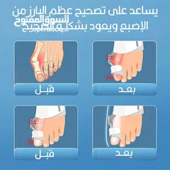  8 جهاز مصحح اصبع القدم القابل للتعديل  الجهاز الحديث بخاصية التعديل لتصحيح اعوجاج إصبع القدم الكبير