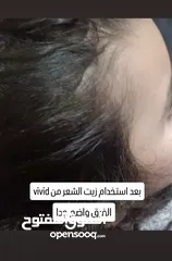  13 كريم ازالة التصبغات والكلف نتائج مضمونه 100%