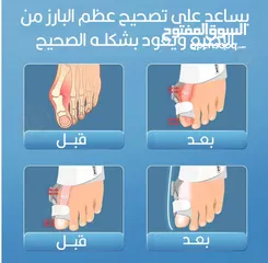  3 مشد الطبي لتصحيح انحراف تقويم الإصبع و مشد قدم اصبع القدم الكبير لكل من يعاني من اعوجاج اصبع القدم