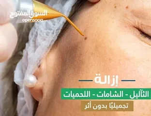  1 جهاز ازالة الثواليل و الوشم الزوائد الجلديه التصبغات جهاز بلازما المحمول بلازماج