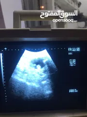  2 فحص الحمل بالسونار (الأشعة التلفزيونية)