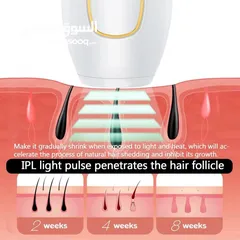  5 ليزر إزالة الشعر بتقنية IPL لكامل الجسم