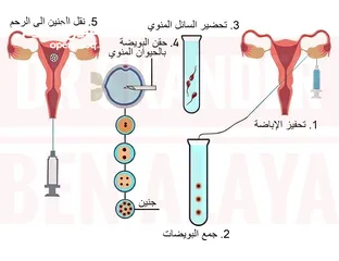  2 دكتورة استشارية حقن مجهرى اوطفال انابيب