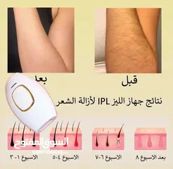  2 جهاز اليزر المنزلي  الثلجي من  ماركة IPL