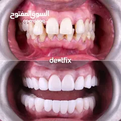  4 معالجة أسنان