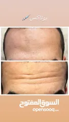  10 خدمات تجميل(حقن)