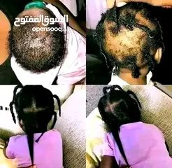  4 *زيت جيكا  الاردني الاصلي* من فوائد الزيت الشهير و المعالج الاول للشعر ناسب 95٪من الحالات  1ـ ت