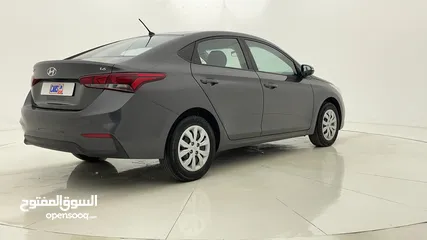  3 (HOME TEST DRIVE AND ZERO DOWN PAYMENT) HYUNDAI ACCENT