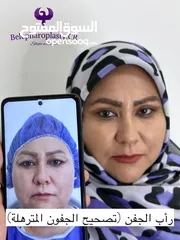  5 القيام بخدمات جراحة تجميل الجسم والوجه