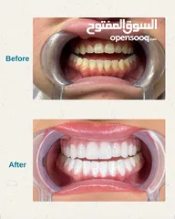  1 معالجة أسنان