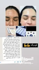  4 كريم تريتوسبوت الأصلي آمن على البشرة مرخص من وزارة الصحه الفلسطينيه