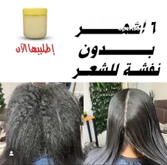  2 بروتين فرد الشعر