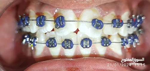  1 علاج اسنان مدينة الرياض