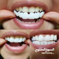  2 طقم اسنان  snapon smile