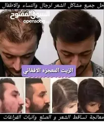  1 زيت المعجزة الزيت الافغاني الامثل لعلاج جميع مشاكل الشعر