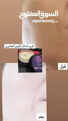  2 كريم الدلال الليلي العلاجي