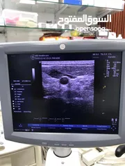  1 Ultrasound