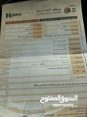  13 هيونداي افانتي MD 2014 للبيع