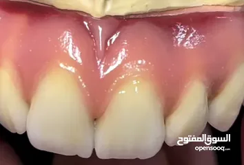  17 مختبرات لين للاسنان لصناعة كافة أنواع التركيبات الثابتة والمتحركة والتركيبات التقويمية وزراعة لاسنان