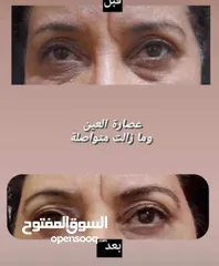  2 ماء مسيلار