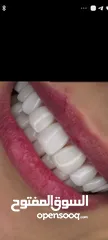  9 طب اسنان او تقليف