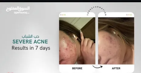  1 منتجات الصحة والمناعة والرياضة وكل شيء تريده