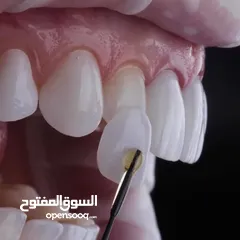  24 مختبرات لين للاسنان لصناعة كافة أنواع التركيبات الثابتة والمتحركة والتركيبات التقويمية وزراعة لاسنان
