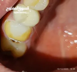  16 علاج اسنان مدينة الرياض