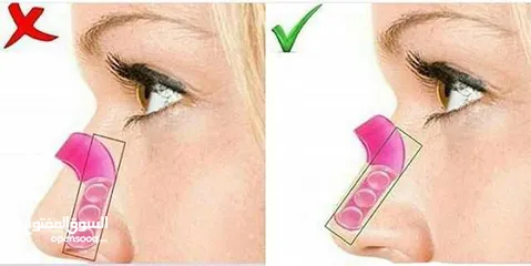  3 جهاز تصغير و تقويم الانف بدون جراحه الجهاز مصنوع من السيليكون ويقوم بعملية تقوي