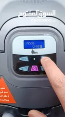  6 بايباب،تنفس ، ثاني اكسيد الكربون، تنفس ليلي، bipap st,