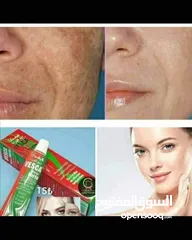  5 كريم فيسكا نيوفورت Vesca newForte لازالة الكلف و النمش و التصبغات الجلدية تركيبة ثلاثية سريعة