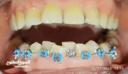  9 علاج اسنان مدينة الرياض