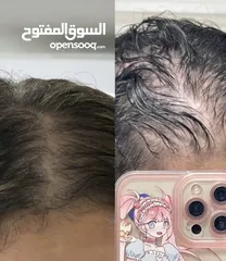  9 زيت رابونزل لتكثيف الشعر وإطالته