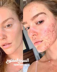  1 غسول انوا الرغوي للتنظيف العميق للمسام  رغوة تنظيف عميقة للمسام بمستخلص هارت ليف توفر تنظيفاً