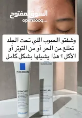  9 كريم لازاله الحبوب طبي