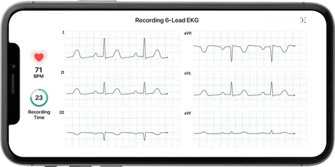  7 جهاز تخطيط القلب المحمول سمارت من KardiaMobile 6L