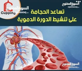  9 مركز شفاء للحجامه  عرض خاص فحص الجسم كامل بجهاز متطور مع 15 كوب حجامه فقط 10ريال