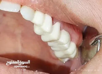  11 علاج اسنان مدينة الرياض