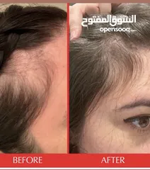  6 كبسولات hairtamin الامريكي الاصلي لتطويل وتثخين وايقاف تساقط الشعر