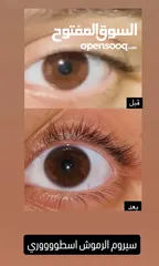  11 زيت رابونزل لتكثيف الشعر وإطالته