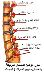  6 كريم قاهر الألم - كريم للعضلات والعمود الفقري والظهر والمفاصل.