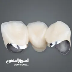  25 مختبرات لين للاسنان لصناعة كافة أنواع التركيبات الثابتة والمتحركة والتركيبات التقويمية وزراعة لاسنان