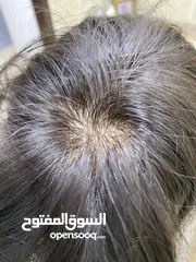  2 باروكة شعر طبيعية