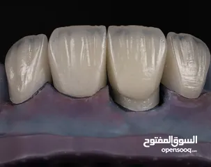  11 مختبرات لين للاسنان لصناعة كافة أنواع التركيبات الثابتة والمتحركة والتركيبات التقويمية وزراعة لاسنان